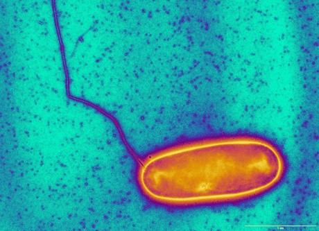 Légionelles et autres bactéries